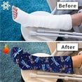 thumbnail image 7 of COEQINE Dragonfly Leg Cast Covers Cast Sleeve for Foot Leg Protector Fashionable Leg Cast Cover Sock Easy to Clean Decorative Leg Cast Cover Knee Cast Sock for Girls Large, 7 of 7