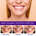 thumbnail image 2 of EELHOE Mousse Dental Púrpura - Blanqueador de Dientes, Elimina Manchas y Mal Aliento - Fórmula Suave Sin Flúor - 45ml para Uso Diario en Casa o Viaje, 2 of 5