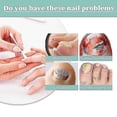 thumbnail image 4 of Nail Repair Pen Onychomycosis Care Solution Cleansing, Brightening, Thickening Onychomycosis Repair Pen Cuticle C, 4 of 4