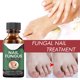 thumbnail image 4 of Lápiz quitauñas líquido de 30 ml para el cuidado de los pies y la onicomicosis, 4 of 7