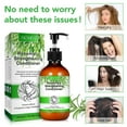 thumbnail image 2 of Aliver Rosemary Strengthening Conditioner-Nourishes and Moisturizes Hair,Supports Longer, Healthier Hair-Rosemary Conditioner 10.56 fl.oz, 2 of 10