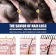 thumbnail image 3 of Scalp Care Cream Scalp Deep Nutrition Dense Hair Repair Hair Follicle Restore Vitality Luster B, 3 of 4