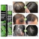 thumbnail image 2 of Hair Growth Spray Growth Liquid Solid Hair Nutrition Moist, 2 of 4