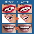 thumbnail image 2 of Dientes postizos moldeables Jaysuing 25g/botella resina, 2 of 8