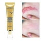 thumbnail image 3 of Lanbena Tcm And Removal Gel - For Wounds, And Burn, 3 of 5
