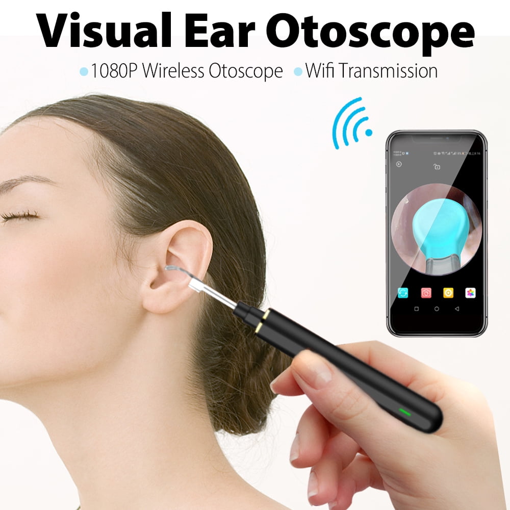 USB Smart Visual Ear Otoscope, 1080P Wireless Otoscope Camera with Ear