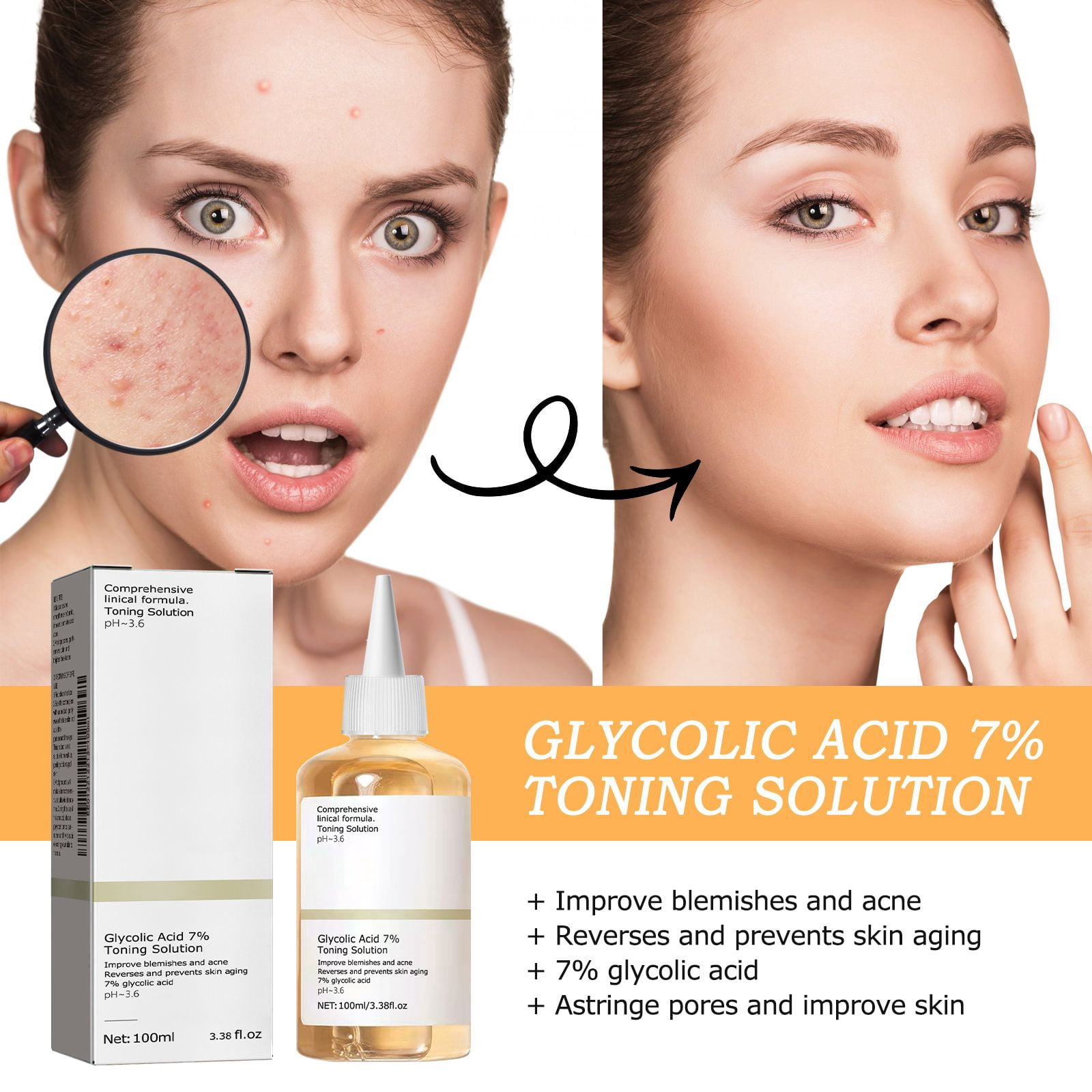 Alvantor Glycolic Acid Exfoliating Face Toner, Hydrating & Pore Minimizing, 3.38 fl oz