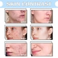thumbnail image 4 of Espuma limpiadora hidratante Limpiador facial espumoso hidratante Eliminación de espinillas, 4 of 6