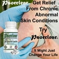 thumbnail image 5 of Psorclear - Formulated for Relief from Chronic Abnormal Skin Conditions!, 5 of 6