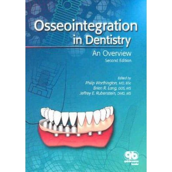 Pre-Owned Osseointegration in Dentistry: An Overview (Paperback) 086715425X 9780867154252