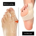 thumbnail image 5 of TWSOUL 9Pcs Bunion Corrector and Bunion Relief Sleeve,Pads Splint Orthopedic Bunion Protector Big Toe Straightener,Protection and Treatment for Hallux Valgus Bunion Pain, 5 of 10