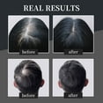 thumbnail image 5 of Mooyam Hair Thickening Fibers, Hair Powder Fill In Fine and Thinning Hair for Men Women, Black, 30g, 5 of 12