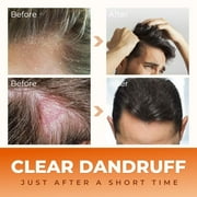 Abera Anti Dandruff Nourishing Shampoo, Hair Growth Support, 6.67 fl oz