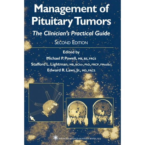Management of Pituitary Tumors: The Clinician's Practical Guide, (Paperback)