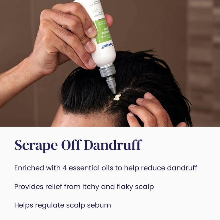 Pre Wash Anti-Recurrence Dandruff Lotion for Severe Dandruff