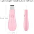thumbnail image 6 of Rongsi Pore Extractor Tool, Black Head Remover for Face and Nose, Blackhead Extractor, Skin Care Tools for Men and Women, Travel Blackhead and Whitehead Removal (Pink), 6 of 7
