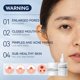 thumbnail image 5 of Set eliminador de puntos negros LANBENA Pore Strips 30 g+sérum 30 ml, 5 of 8