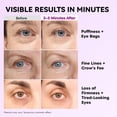 thumbnail image 3 of Tensor de ojos RONKIE Instant Firm, fórmula mejorada, 20 ml, 3 of 7