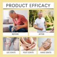 thumbnail image 4 of 20g Bee Venom Joint and Bone Therapy Cream, Relieves Lumbar Spine Shoulder Neck Joint Muscle Pain and Discomfort Care Cream, 4 of 5