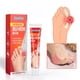 thumbnail image 4 of Crema De Gota Ungüento para aliviar el dolor de juanetes y gotas, 20g, masaje, crema para el dolor de los dedos de los pies, herramienta para el cuidado de los pies, 4 of 9