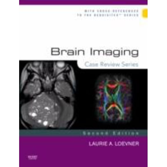Pre-Owned Brain Imaging: Case Review Series (Case Review) Hardcover