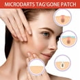 thumbnail image 2 of Parches de nanomicroagujas, parches hidrocoloides para el acné, cobertura invisible diurna para el cuid facial, aptos para todo tipo de piel., 2 of 4