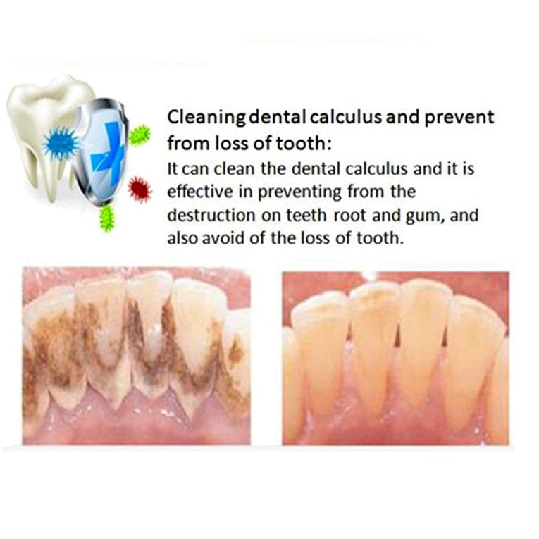 Waterfree Ultrasonic Teeth Cleaning Machine Home Use Oral Irrigator CN