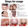 thumbnail image 5 of Herbal Spots Peel-Off Facial Mask, Spot Peel off Mask, Anti-Aging Anti-Wrinkle Tear-Off Mask, Deep Nourishment & Pore Tightening, 5 of 5