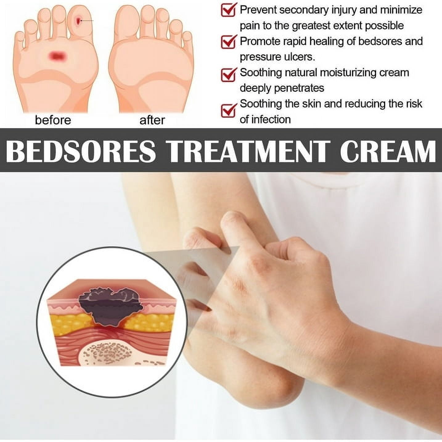 Decubitus Cream Pressure Sore Ulcer Skin Relief Ointment Bed Sore Wound Healing Treat Anti Dry Repair Moisturizing Body Care 20g