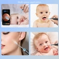 thumbnail image 2 of Ear Wax Removal Tool with 2MP 1080P Camera 6 LED Lights 360 Degree View Ear Cleaner with 6 Silicone Tips, 2 of 3
