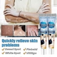 thumbnail image 3 of Vitiligo Skin Repair Cream,Vitiligo Treatment Cream, Dispose of White Spots on Skin and Improve Skin Pigmentation_c*, 3 of 4