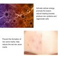 thumbnail image 4 of Pen Portable LED Light Therapy Pimple Removal Pen Skin Care Repairing Instrument, 4 of 7