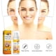 thumbnail image 1 of Crema de eliminación de acné quístico Ndcxsfigh 30ml reparación hidratante antiacné blanqueamiento, 1 of 9