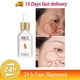thumbnail image 1 of Suero abrillantador para la cara, producto coreano, eliminador de manchas oscuras, pecas, aclara la marca del acné, blanqueamiento, mejora la luminosidad, hidrata la piel, 1 of 5