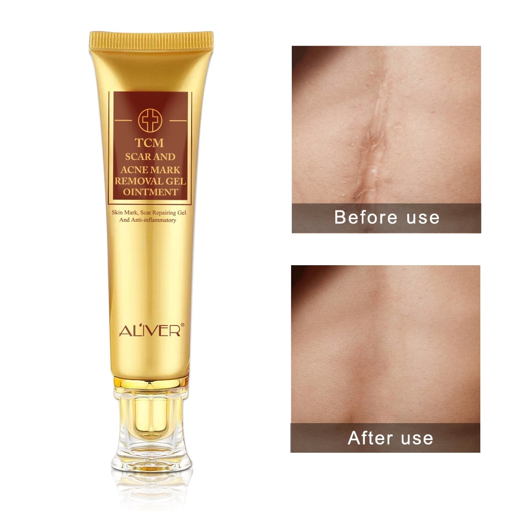 ALIVER Scar Cream - TCM Scar and Acne Mark Removal Gel Ointment for Scars, Burns, Stretch Marks, Acne Spots, Skin Redness Curing - 3 Pack