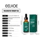 thumbnail image 2 of Productos para el cuidado del cabello: aceite para la foliculitis del cuero cabelludo, aceite capilar para el cuero cabelludo, aceite natural para el cabello y el cuero cabelludo, nutritivo para punta, 2 of 5