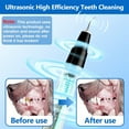 thumbnail image 3 of Kit de limpieza de dientes para mascotas, cepillo de dientes con 5 modos, Kit de eliminación de placa de sarro para perros y gatos, 3 of 4