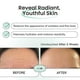 thumbnail image 5 of Parches antiarrugas Petite Pluie Korean Advanced Hydrogel x10, 5 of 7