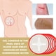 thumbnail image 2 of Adhesivo Emergencia para Traumatismos Transpirable Heridas 6 Uds., 2 of 6
