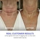 thumbnail image 5 of Crema reafirmante para cuello GoPure Beauty, paquete de 2 unidades, 50 ml, antienvejecimiento, 5 of 8