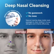 Nascool Nasal Irrigation System with 50 Salt Packets, Sinus Rinse Machine for Nasal Symptoms