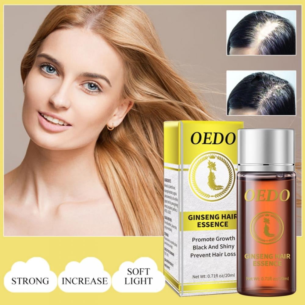 Ginseng Hair Oil 20ml Stop Hair Loss, Hair Thinning Treatment, Biotin Oil  Hair Oil, Used for Hair Growth And Dry Damaged Hair 