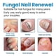 thumbnail image 4 of Nail Repair Spray Repair And Clean Nails, Hands, Feet, Soft Nails, Thicken Nails, Polish Nails,100ml, 4 of 5