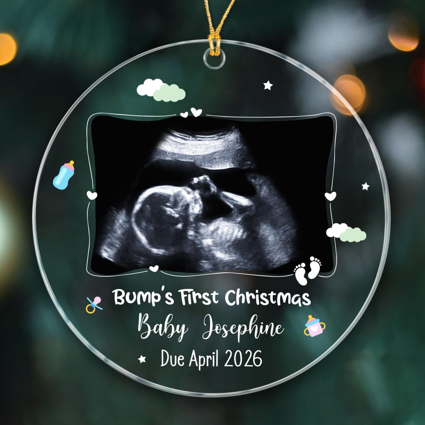 Photo Ultrasound Baby Christmas Ornaments 2025, Bump's First Christmas Ornament, Baby Coming Xmas Ornament Gift for Pregnancy Announcement, Custom Date/Name/Photo Baby Sonogram Ornaments