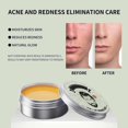 thumbnail image 2 of Refurbished Fenull 3-in-1 Night Cream Skin Care Set Organic Formula for Sensitive Skin Multi-Color One Size, 2 of 3