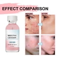 thumbnail image 2 of ABPWLY Lotion for Rough and Bumpy Skin D Hyaluronic Lactic and Salicylic Lotion 30ml Clearance Body Moisturizer Canada Days Body Moisturizer Moisturizer, 2 of 8