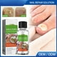 thumbnail image 1 of tratamiento de uñas,uña del pie dañada tratamiento de hongos en amarillas,Solución de tratamiento de hongos en de los pies de 30 ml,fórmula líquida amarilla para el Macarena tratamiento de uñas, 1 of 8