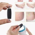 thumbnail image 4 of Foot Grinder Refills, Accessory Foot Grinder Replacement Heads  For Electric Callus Remover, 4 of 8