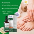 thumbnail image 2 of Gotas reparadoras de uñas de árbol de té Aceite para el tratamiento de hongos en las uñas Eliminación de hongos en los dedos de los pies Mejora la onicomicosis Suero para el cuidado de los pies, 2 of 6