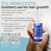Men’s 5% Scalp Solution Minoxidils | Daily Topical Hair Care Formula for Thicker, Fuller-Looking Hair | Lightweight Scalp Care for Stronger-Looking Hair & Healthy Scalp Feel